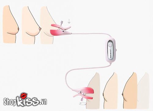 Núm vặn điều chỉnh lực kẹp trên Lovense Gemini cho phép tùy chỉnh độ siết chặt